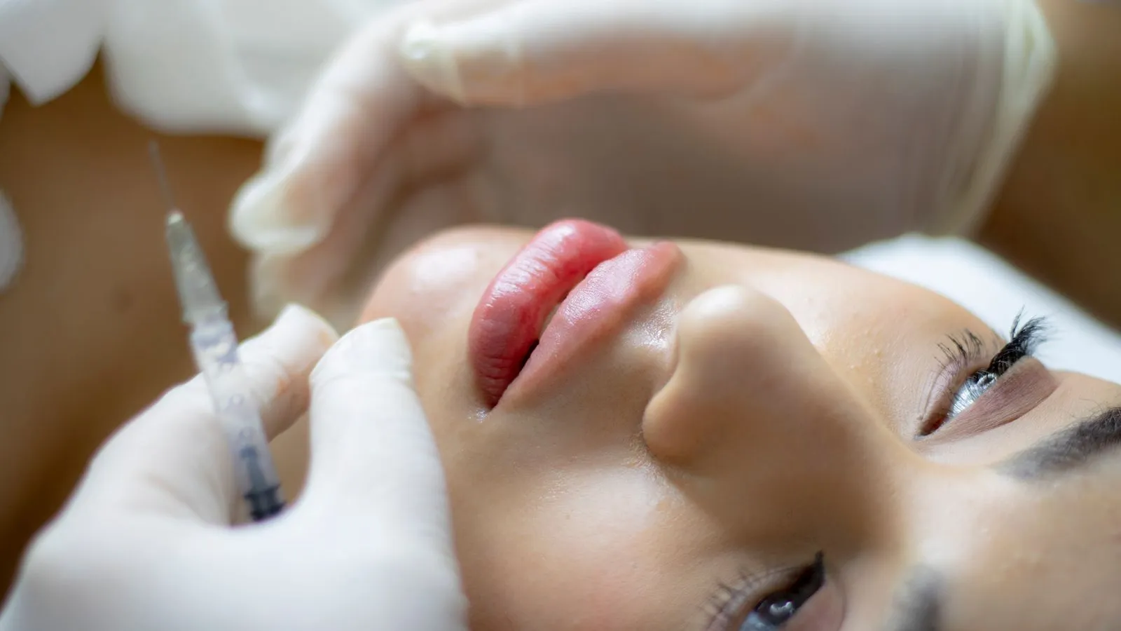 Tratamiento de armonización facial con ácido hialurónico en la Clínica Dental Dra. Beatriz Gómez