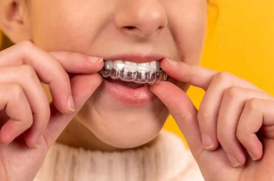 Paciente colocándose un alineador dental transparente, tratamiento de ortodoncia invisible